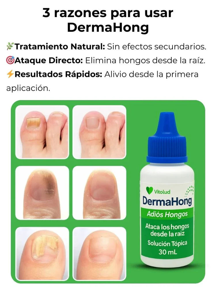 Elimina los hongos desde la raíz y recupera la salud, la confianza y la libertad de mostrar tus pies.