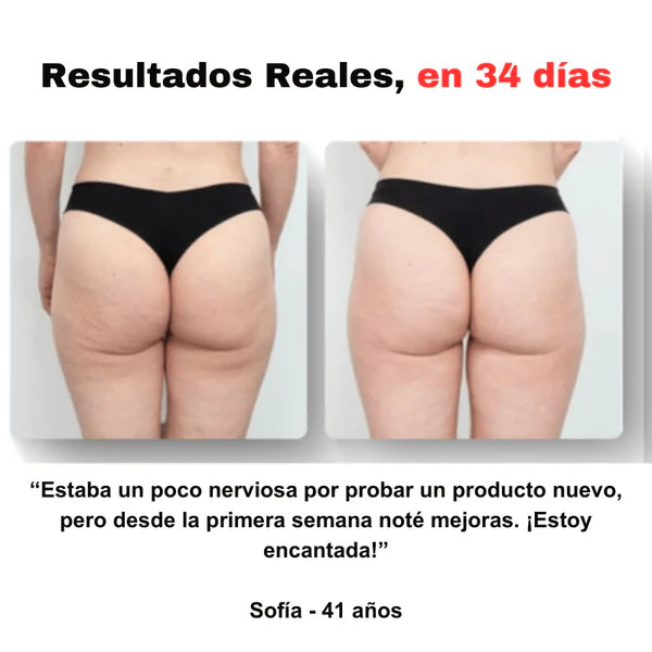 Reduce celulitis y moldea tu cuerpo desde casa.