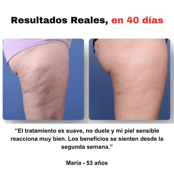 Reduce celulitis y moldea tu cuerpo desde casa.