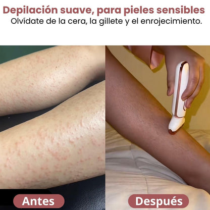 Suavidad instantánea, sin dolor y sin salón.